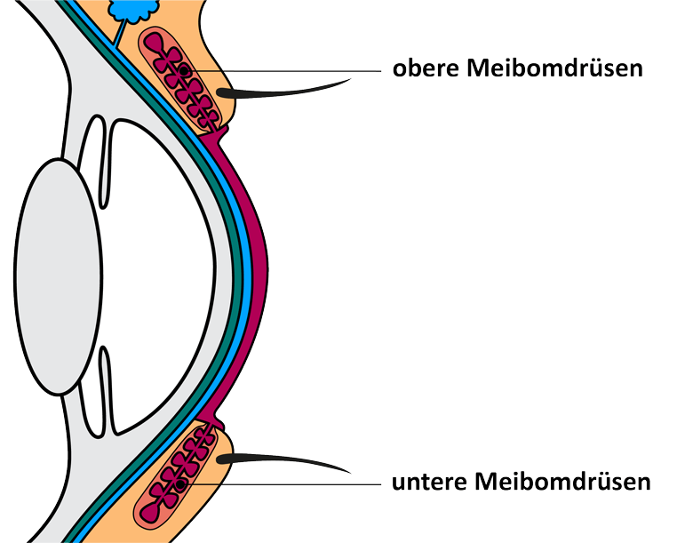 Grafik trockene Augen